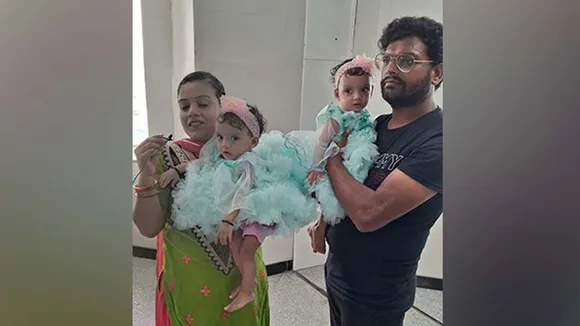 Conjoined Twins Ridhi Sidhi