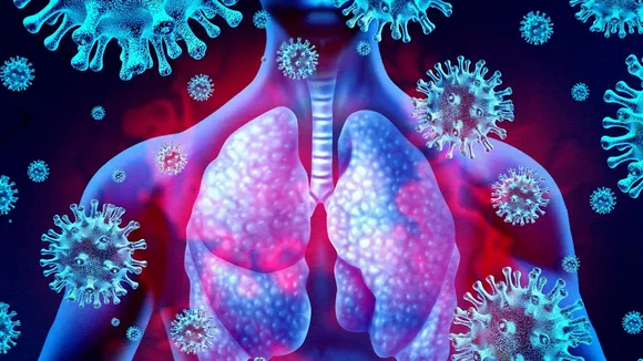 Lungs Coronavirus Infection.jpg