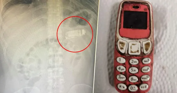 Mobile phone Stomach Prisoner