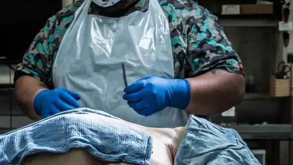 autopsy