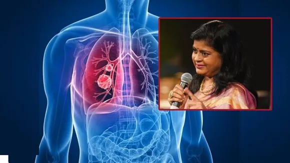 ಸಿಗರೇಟ್ ಸೇದದವರಿಗೆ ಲಂಗ್ ಕ್ಯಾನ್ಸರ್‌.. ಅಪರ್ಣಾ ಸಾವಿನ ಬೆನ್ನಲ್ಲೇ ಹೆಚ್ಚಿದ ಆತಂಕ; ಏನಿದು ಅಪಾಯ?