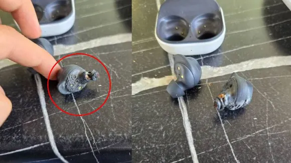 ಕಿವಿಯಲ್ಲಿದ್ದಾಗಲೇ ಇಯರ್​ ಬಡ್​​ ಸ್ಫೋಟ.. ಶ್ರವಣ ನಷ್ಟ ಅನುಭವಿಸುತ್ತಿರೋ ಯುವತಿ