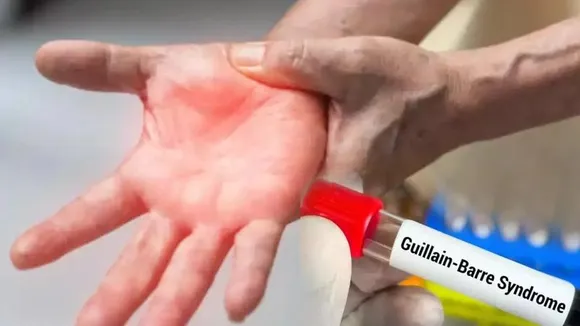 ಹೈದರಾಬಾದ್​​ನಲ್ಲಿ ಮೊದಲ ಗುಯಿಲಿನ್ ಬ್ಯಾರೆ ಸಿಂಡ್ರೋಮ್ ಪತ್ತೆ.. ಕೋಲ್ಕತ್ತಾದಲ್ಲಿ 4 ದಿನಲ್ಲಿ 3 ಜೀವ ಹೋಗಿದೆ