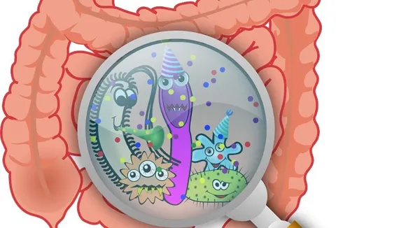 <strong>Intestinal cancer, a rare cancer increasingly becoming common in people in Bengaluru</strong>