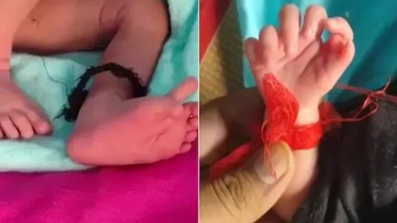 Rajasthan: Newborn with 26 fingers likened to Dholagrah Devi