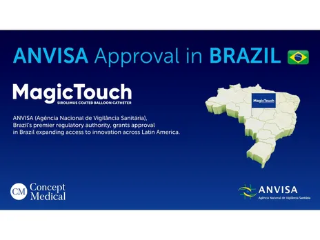 Revolutionary ANVISA Approval Advances Cardiovascular Treatment in Brazil with Concept Medical’s MagicTouch