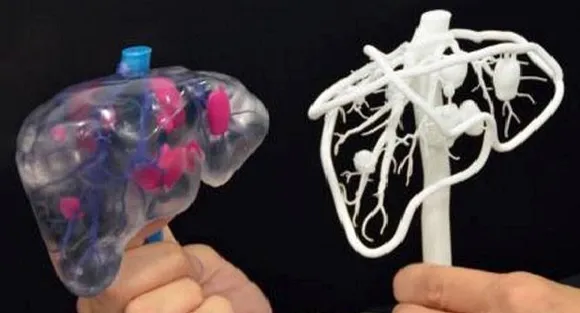 Low cost 3D human organ models in the offing