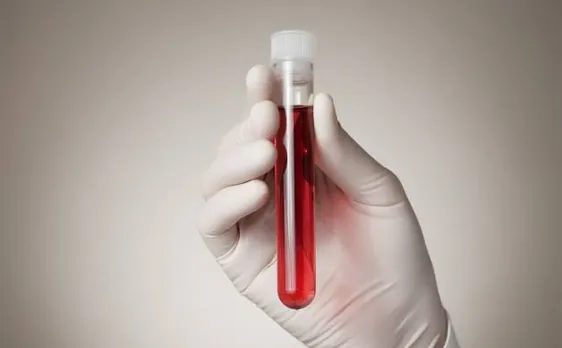 Encapsulating blood samples in air-dried silk protein can preserve without refrigeration