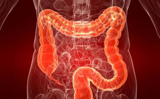 Scientists create 3D hydrogel biochips to diagnose bowel cancer at early stages