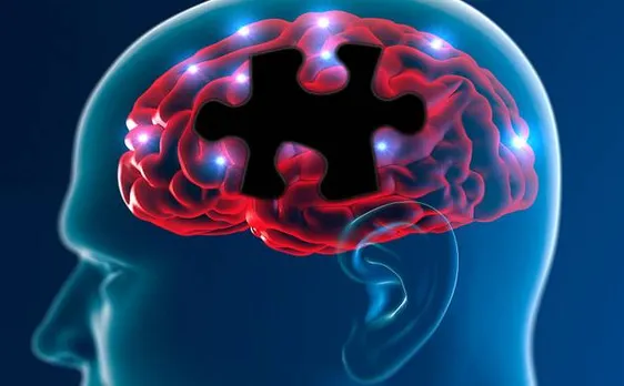 Scientists identify enzyme that may help fight Alzheimer