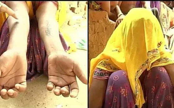 My father is a thief: In-laws rape, tattoo woman's body with abuses in Rajasthan