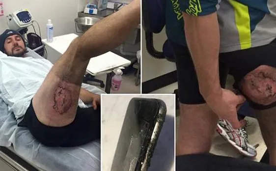 iPhone 6 explodes in pocket, victim tags Tim Cook in picture