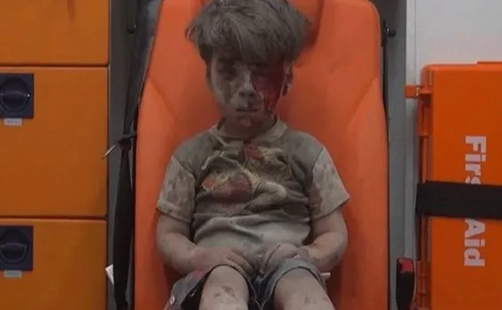 Brother of Omran, Syrian boy in haunting picture, dies