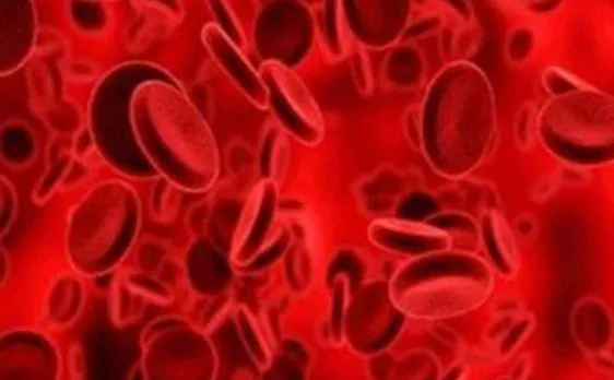 3D printed, lifelike blood vessel structure created by scientists