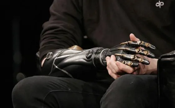 'Electronic Skin' with a sense of touch: Researchers opens up the possibility for solar-powered prosthetic limbs