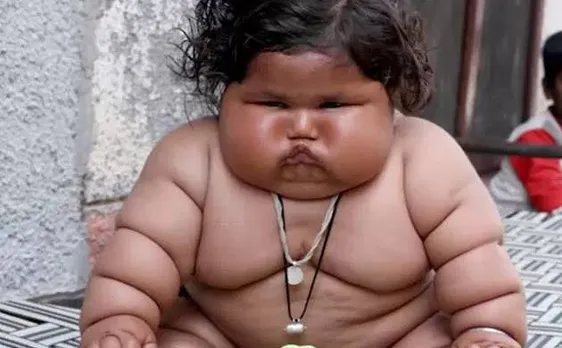Chahat Kumar of Punjab alarms doctors with her morbid obesity