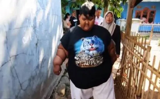 Ten-year-old boy suffering from abnormal weight, addicted to cola and noodles