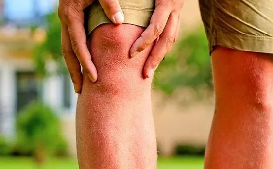 Osteoarthritis affects more women than men, obesity major factor behind the problem: Study