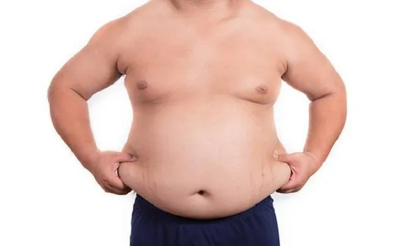 Don't hold off weight loss surgery till you become extremely obese: Study