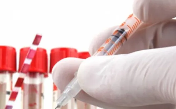 Scientists develop proteins using electricity and CO2