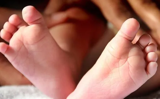 Doctors save child born with two penises and extra limbs 