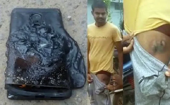 Xiaomi Redmi Note 4 explodes in pocket of owner, suffers injury
