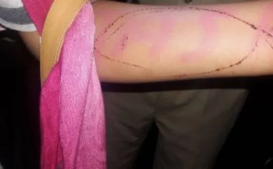 Blue Whale Challenge: Jodhpur police rescues girl trying to commit suicide 