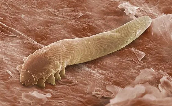 Climate change may erase one-third of parasite species by 2070, claims study