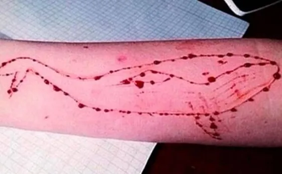 Blue Whale Challenge: Two Bengaluru boys sent for counselling sessions after spotted with injured wrist