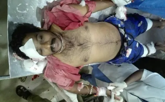 Kerala: Miscreants attack RSS activist in Kannur, BJP claims assault handiwork of CPI-M