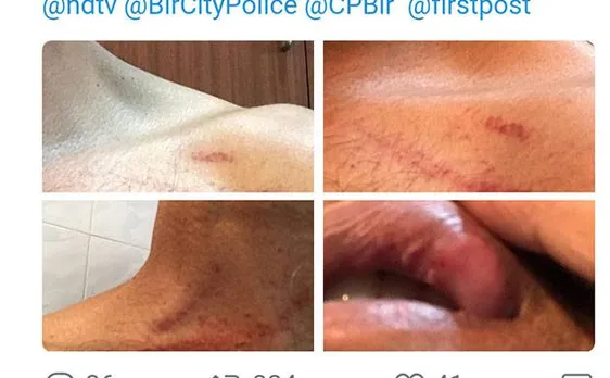 Group of Uber drivers allegedly beat lone passenger in Bengaluru over seat belt