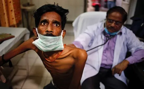 Scientists discover substance that prevents membrane formation of tuberculosis
