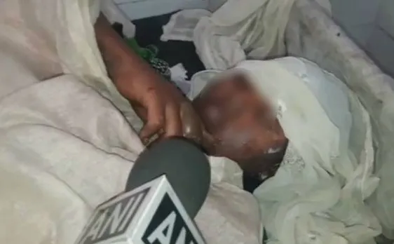 Minor Dalit girl torched in Madhya Pradesh for resisting rape