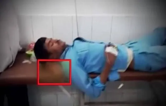 Patientâ€™s severed leg used as pillow in Jhansi medical college, probe ordered