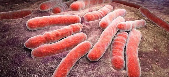 New blood test can diagnose tuberculosis two years in advance