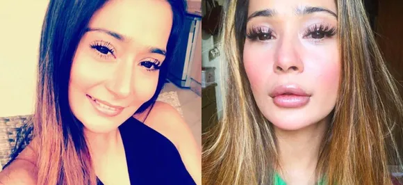 Sara Khan on being brutally trolled for lip surgery: I wanted fuller lips and got it done; trolls donâ€™t deserve much attention