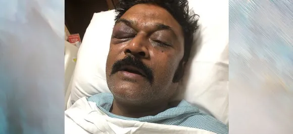 Karnataka Congress MLA Anand Singh files FIR against another party MLA JN Ganesh over alleged assault