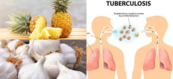 World Tuberculosis Day:  Natural remedies that can soothe the symptoms of TB