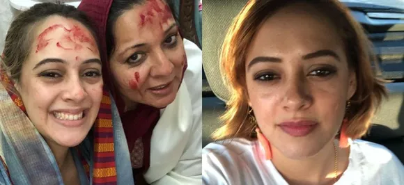 Yuvraj Singhâ€™s wife Hazel Keech undergoes nose surgery, thanks her mother-in-law with a heartwarming post