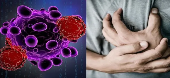 Cancer therapy may up heart disease, diabetes risk in men: Study