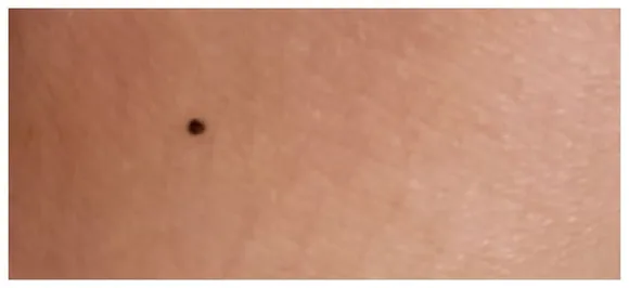 Women are freaking out over how loads of them have a freckle on SAME spot, do you have one too?