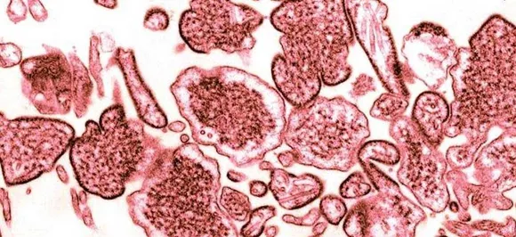 Nipah Virus: Sample of seventh Keralite suspected to be infected tests negative