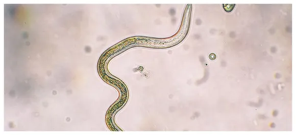 Scientists discover new method to kill drug-resistant parasites