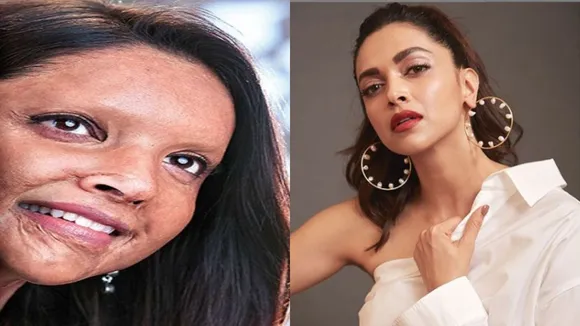 Deepika Padukone Had To BURN Piece Of Prosthetics To 'Heal Emotionally' After Chhapaak's Shoot