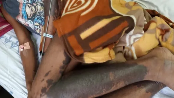 Delhi: 3 Killed After Coming In Contact With Deadly Chemical Spilled On Road