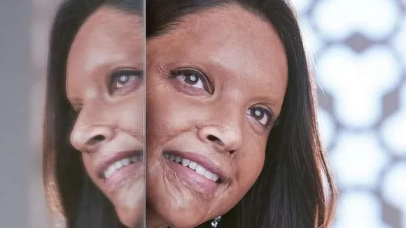 Chhapaak Box Office Collection Day 8: Deepika Padukoneâ€™s Film Fails To Do Impressive Business