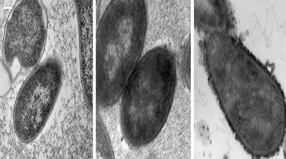  In Pics: Bacteria on NASA's ISS changing their shape, become more resistant to antibiotics