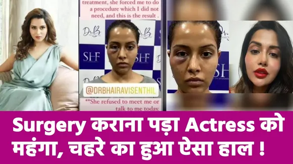 Tamil Actress Raiza went for Face Surgery, Now in Trouble