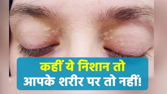 White marks around the eyes are not normal, don`t ignore it