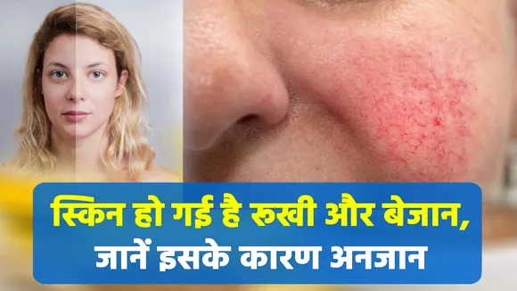 Factors behind your dry and lifeless skin